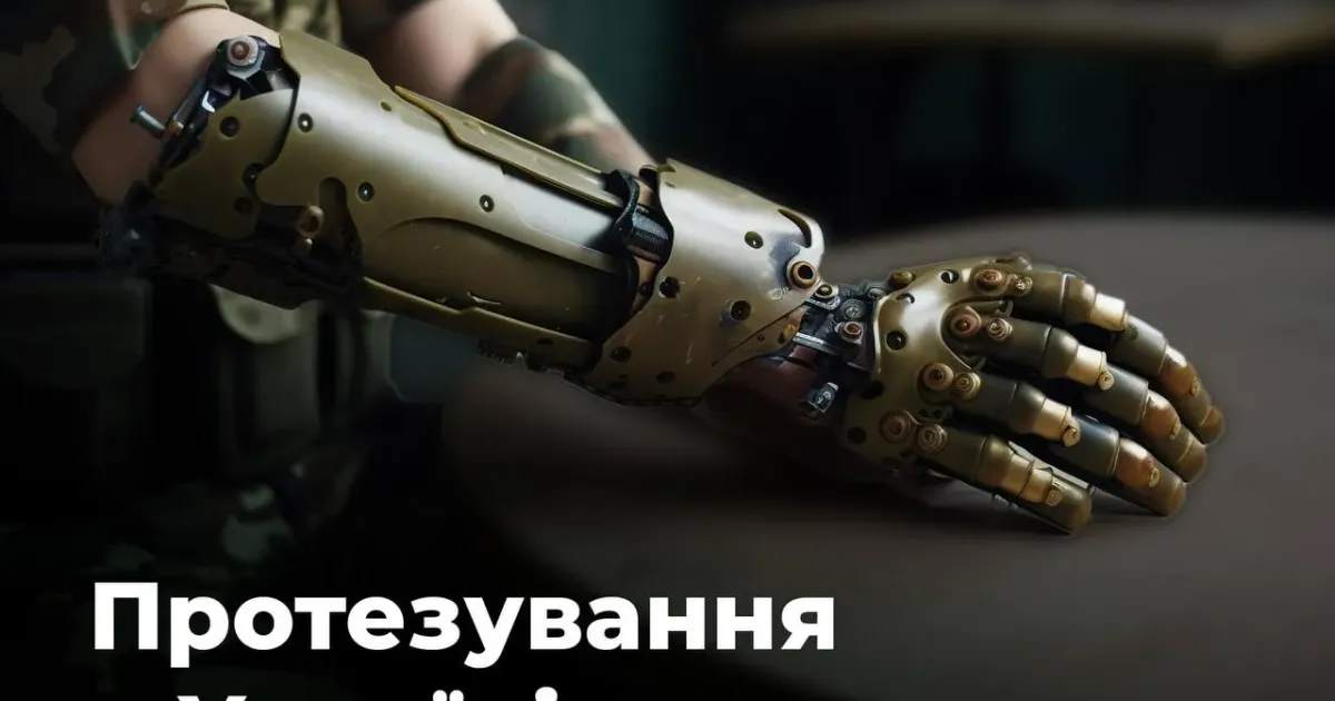 Як отримати безплатний протез? Протезування в Україні – безкоштовне